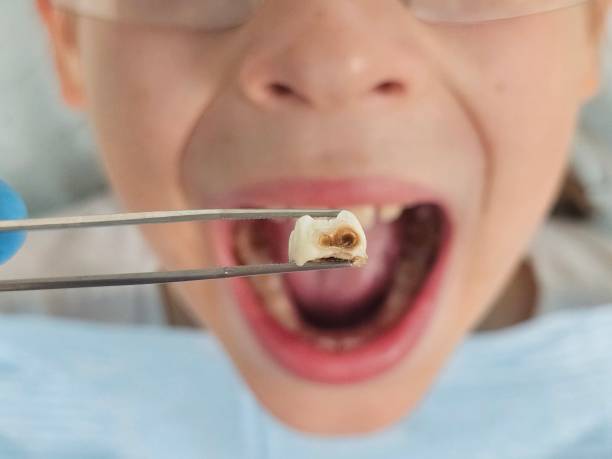 Best Mobile Emergency Dentist in Bellville, TX