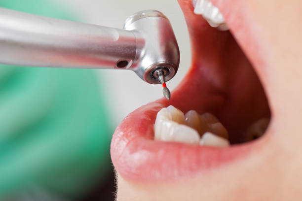 Best Holiday Emergency Dentist in Bellville, TX